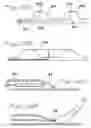 Fig. 11 - Catheter system with on-board temperature probe