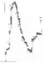 Fig. 06 - Polypeptide hormone phosphatonin