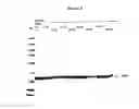 Fig. 07 - Modified human four helical bundle polypeptides and their uses