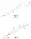Fig. 02 - Steerable catheter with rapid exchange lumen