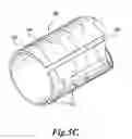 Fig. 06 - Steerable catheter with rapid exchange lumen