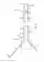 Fig. 03 - Guidewire structure including a medical guidewire and method for using