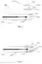Fig. 02 - Method of delivering temperature controlled intraocular lens