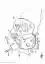 Fig. 02 - Device for installing stasis reducing means in body tissue