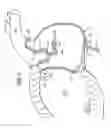 Fig. 07 - Device for installing stasis reducing means in body tissue