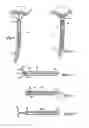 Fig. 09 - Device for installing stasis reducing means in body tissue