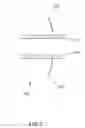 Fig. 04 - Vascular Prosthesis with Attachment Means and Connecting Means