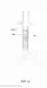 Fig. 14 - Vascular Prosthesis with Attachment Means and Connecting Means
