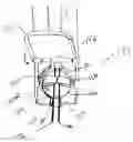 Fig. 01 - Method of preparing a multielement intraocular lens for insertion
