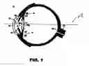 Fig. 02 - Method of preparing a multielement intraocular lens for insertion