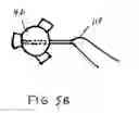 Fig. 08 - Method of preparing a multielement intraocular lens for insertion