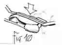 Fig. 13 - Method of preparing a multielement intraocular lens for insertion