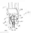 Fig. 16 - Method of preparing a multielement intraocular lens for insertion
