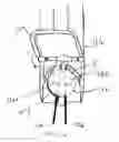 Fig. 17 - Method of preparing a multielement intraocular lens for insertion