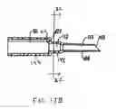 Fig. 19 - Method of preparing a multielement intraocular lens for insertion