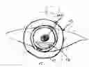 Fig. 01 - MOVABLE OPHTHALMIC LENS ASSEMBLY