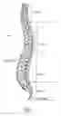 Fig. 02 - Prostheses, Systems and Methods for Replacement of Natural Facet Joints With Artificial Facet Joint Surfaces