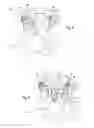 Fig. 07 - Prostheses, Systems and Methods for Replacement of Natural Facet Joints With Artificial Facet Joint Surfaces