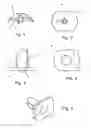 Fig. 02 - Ankle Joint Endoprosthesis Elements