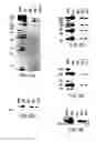 Fig. 06 - Transgenic mammals having human Ig loci including plural Vand V regions and antibodies produced therefrom