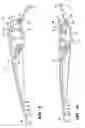Fig. 06 - Wiper arm assembly having a locking catch