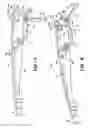 Fig. 05 - Wiper arm assembly having locking surfaces