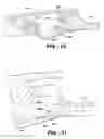 Fig. 07 - Wiper arm assembly having locking surfaces