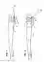 Fig. 02 - Wiper arm assembly having locking arms
