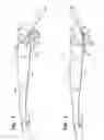 Fig. 03 - Wiper arm assembly having locking arms