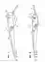 Fig. 05 - Wiper arm assembly having locking arms