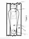 Fig. 06 - DRAPERY CARRIER