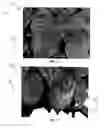 Fig. 07 - Decorative coatings for plants and plant materials