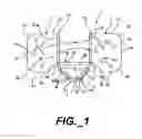 Fig. 02 - Variable girder tie