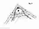 Fig. 03 - Connectors and Methods of Construction for a Precast Special Concrete Moment Resisting Shear Wall and Precast Special Concrete Moment Resisting Frame Building Panel System
