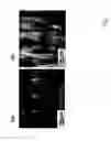 Fig. 02 - Nanotube-Based Nanoprobe Structure and Method for Making the Same