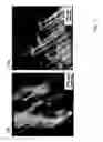 Fig. 08 - Nanotube-Based Nanoprobe Structure and Method for Making the Same