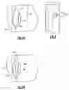 Fig. 04 - Method for checking wall thickness of hollow core airfoil