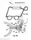 Fig. 10 - Universal endpiece for spectacle temples