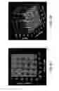 Fig. 07 - Controlling pulses in optical microscopy