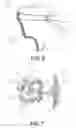 Fig. 05 - Luminous skirt