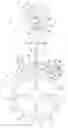 Fig. 01 - Device and method for securing a pallet-stone to an escapement pallet of a timepiece movement