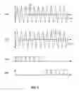 Fig. 08 - Switching amplifier circuits and methods