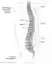 Fig. 01 - Distorting feature compensating