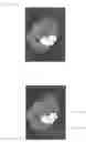 Fig. 04 - Image generator for medical treatment and its method