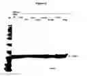 Fig. 07 - Modified Human Growth Hormone