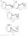 Fig. 07 - Prebiotic Preparation