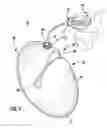 Fig. 04 - METHOD FOR DISPENSING LIQUID INTO DRINKING CONTAINER WITH LIQUID DISPENSER MOUNTABLE TO DRINKING CONTAINER