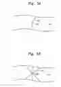 Fig. 05 - ADHESIVE, POLARIZER USING THE SAME, AND LIQUID CRYSTAL DISPLAY HAVING THE SAME