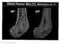 Fig. 01 - PTHRP-BASED PREDICTION AND DIAGNOSIS OF BONE DISEASE