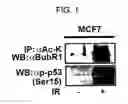 Fig. 02 - Method for screening an anticancer drug using acetylated BubR1